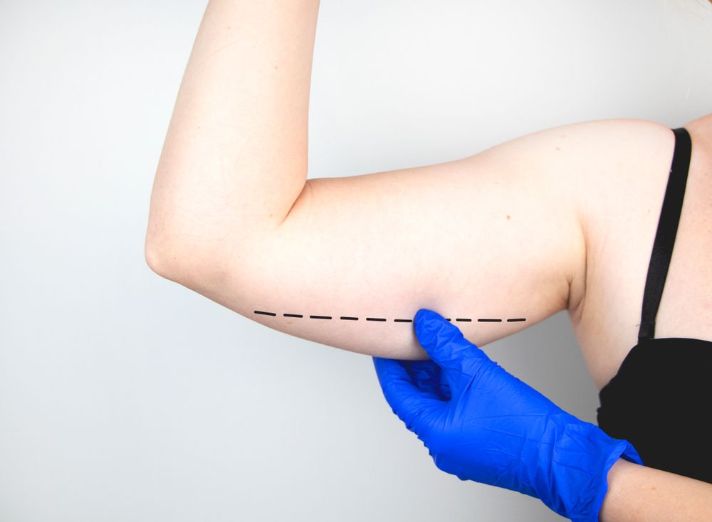 A,Plastic,Surgeon,Is,Preparing,To,Tighten,The,Skin,Of