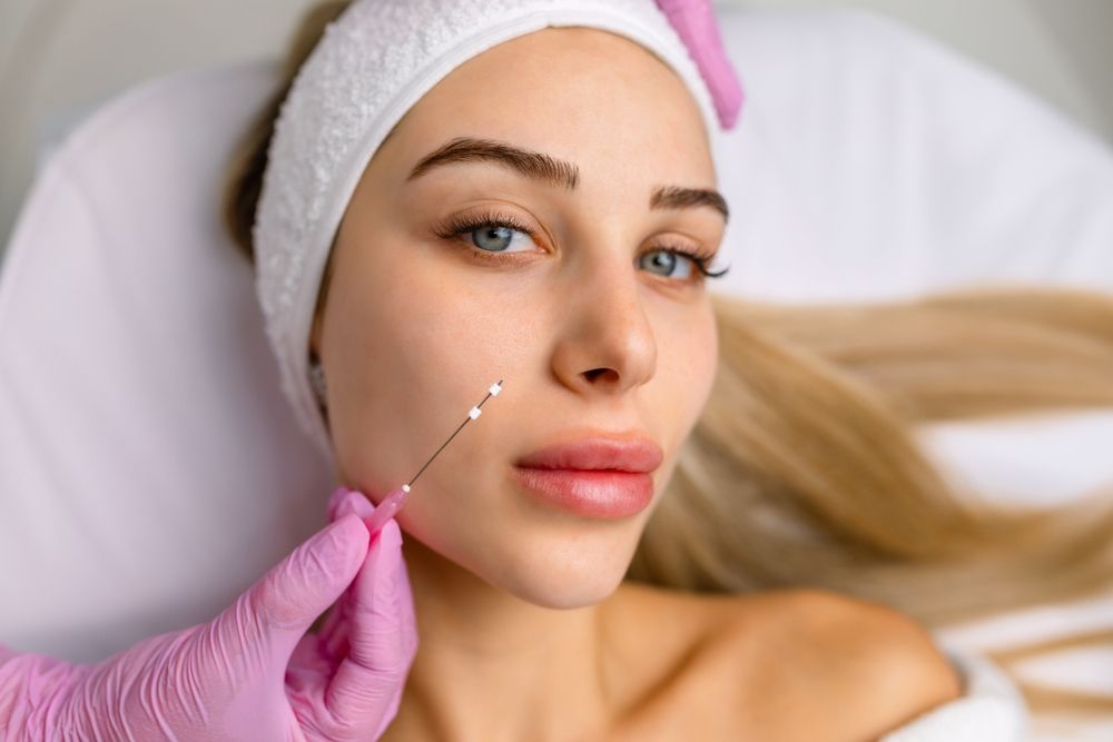 Face,Lifting,Pdo,Suture,Operation.,Innovative,Technique,Of,New,Thread