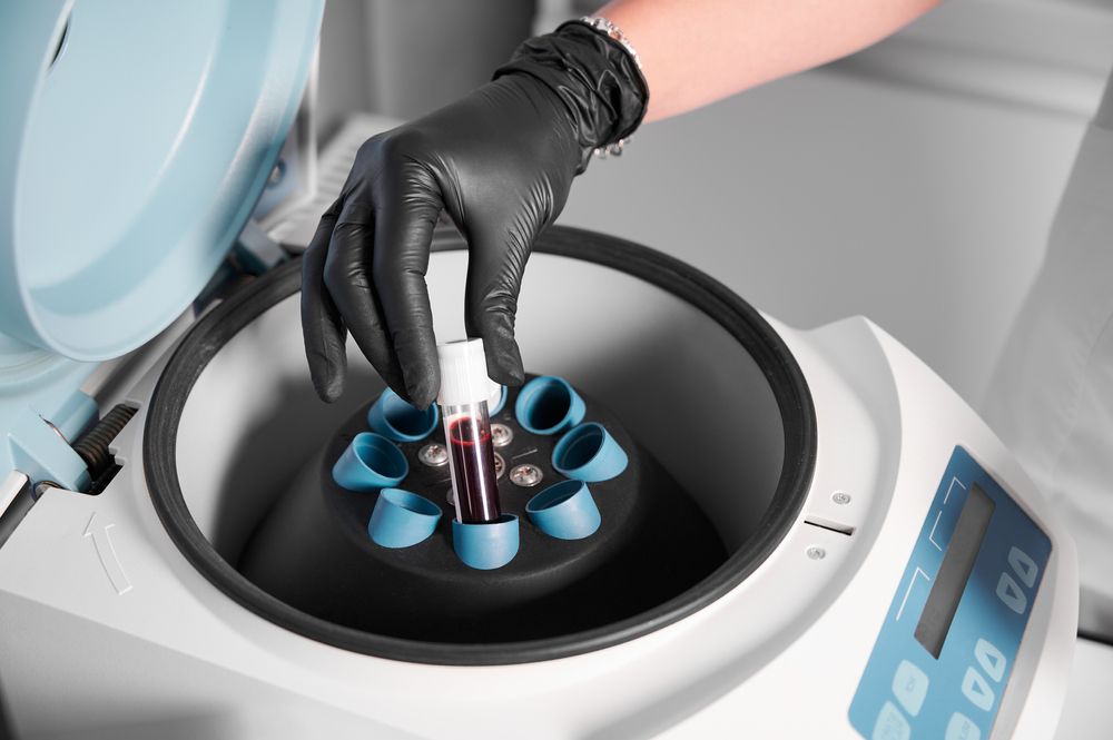 Plasmolifting,Process.,Preparation,Of,Blood,For,Injections.,Cosmetologist,In,Black