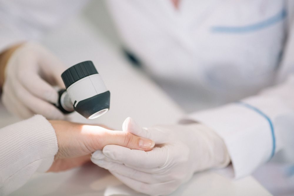 Closeup,Of,Dermatologist,Examining,Mole,On,Hand,Of,Female,Patient