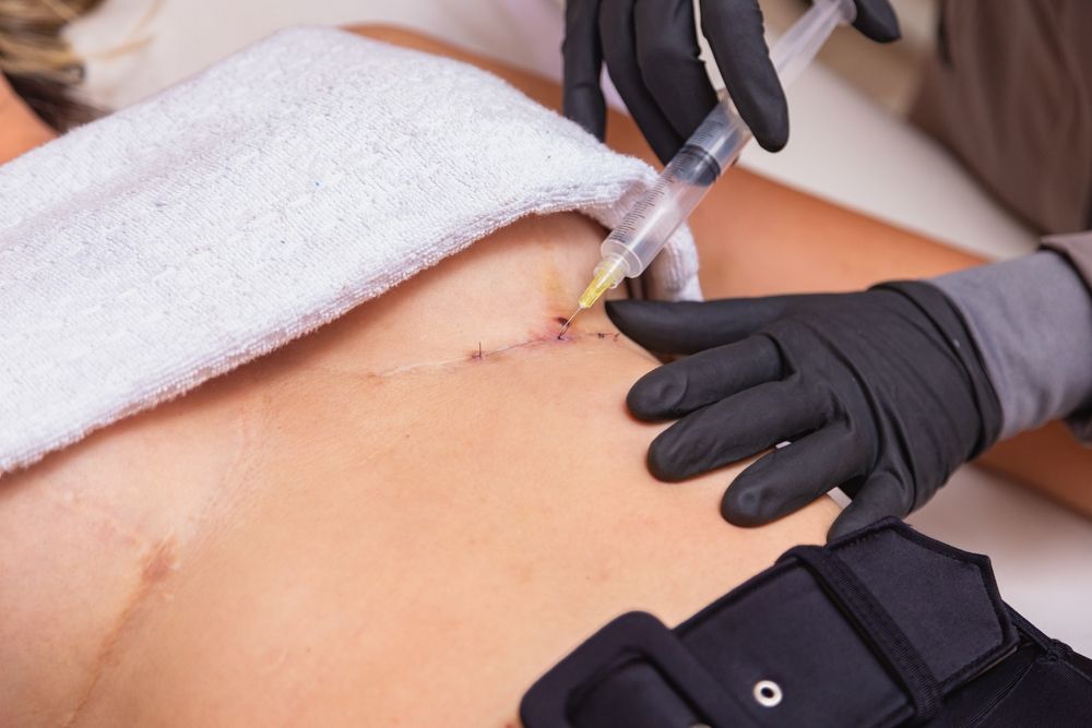 Aesthetic,Healing,Procedure,Using,Ozone.,Woman,Applying,Ozone,After,Plastic