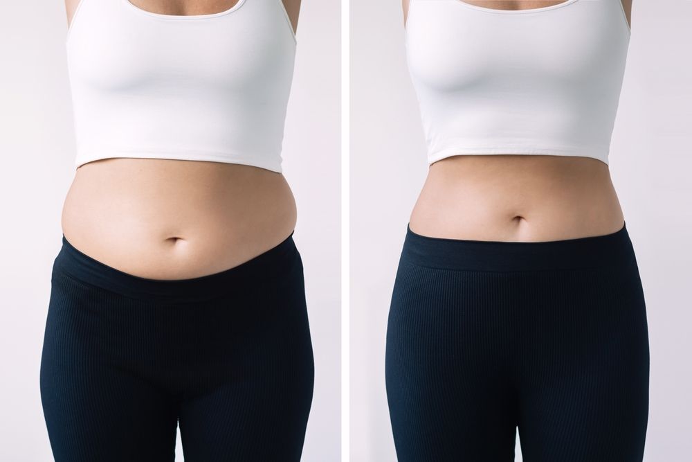 Young,Woman,With,Excess,Fat,And,Toned,Slim,Stomach,With