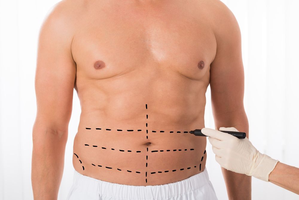 Close-up,Of,Person,Hands,Drawing,Perforation,Lines,On,Stomach,With
