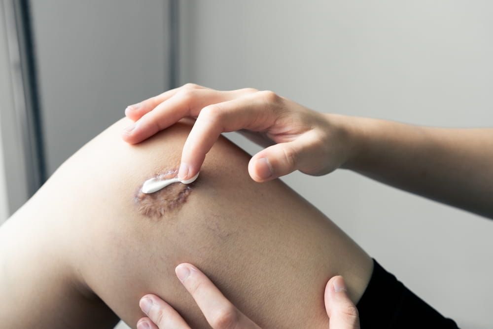 The image highlights self-care, medication application, and skin healing processes for injuries or scars.