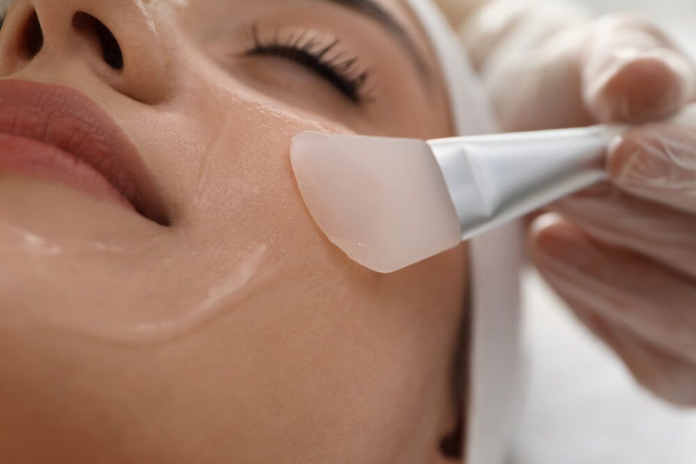 girl face during chemical peel