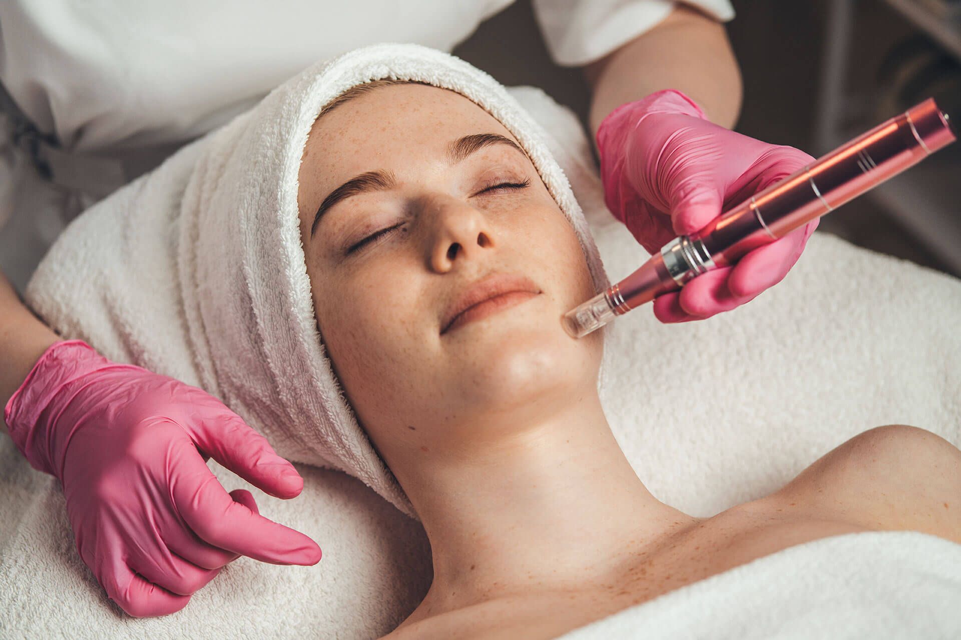 Microneedling SkinPen & Evo on Face