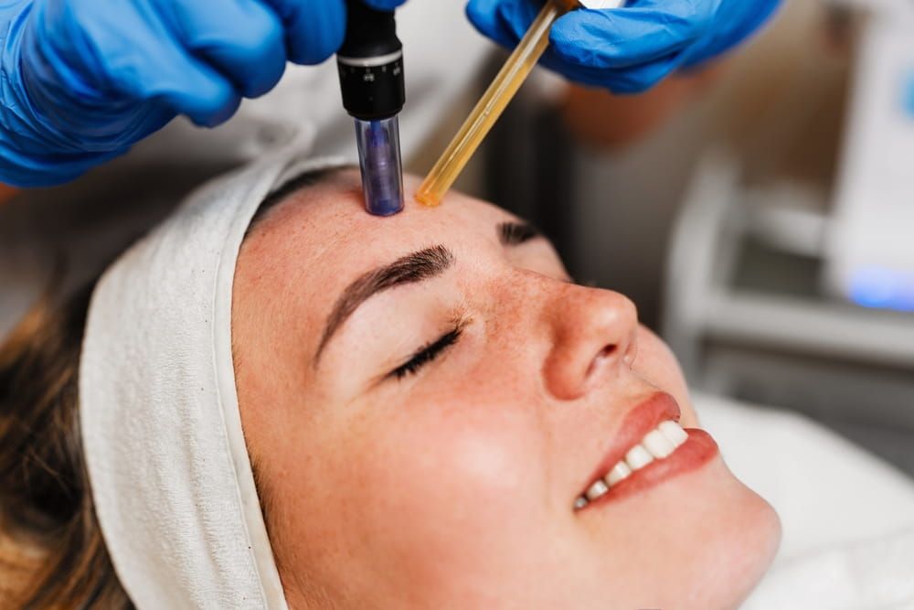 Beautician wearing blue gloves uses a microneedling pen to apply serum to forehead of client with closed eyes lying on a treatment table