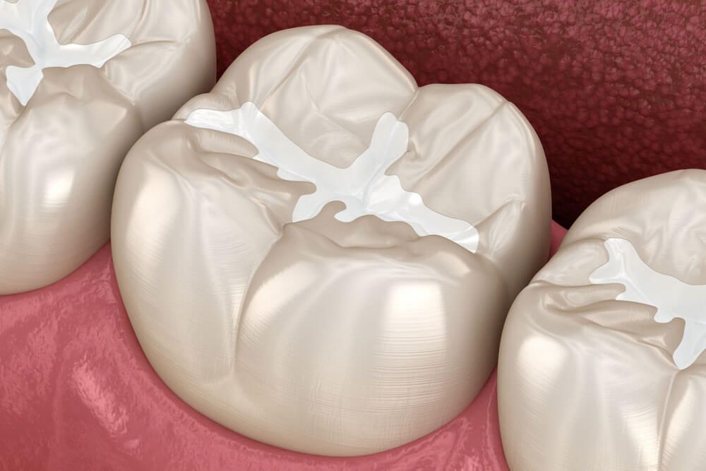Medically accurate 3D illustration of dental concept