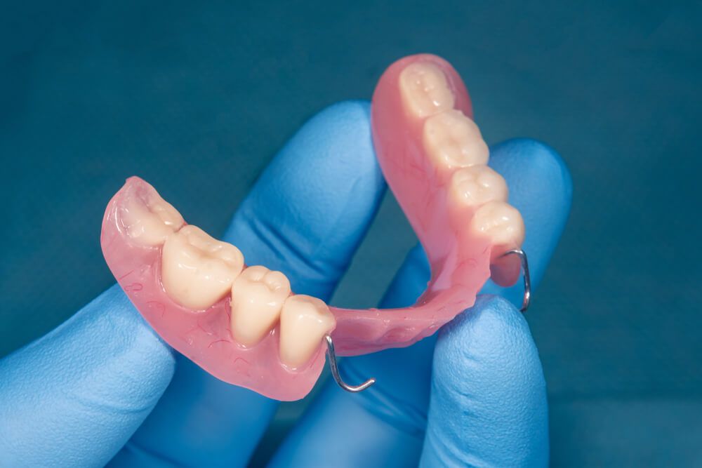 Gentle Touch Dental Expert Removable Partials Dentures in Clifton, NJ