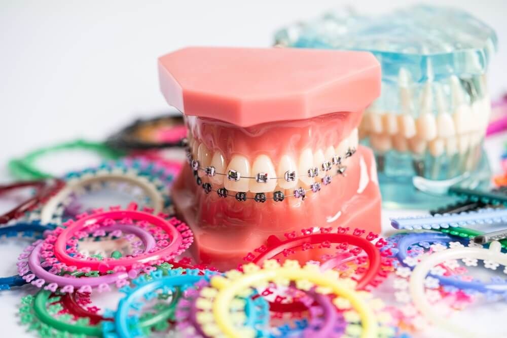 Preventive Orthodontics