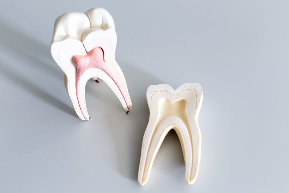 Root Canal Treatment
