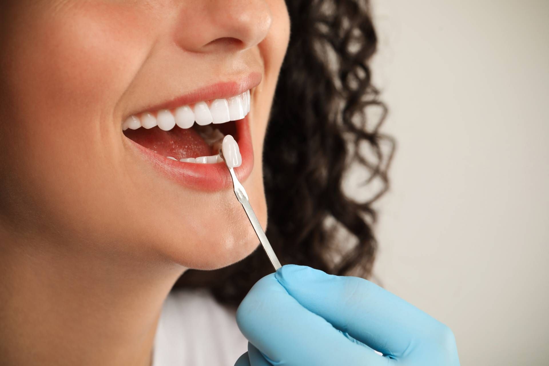 Dental crown and their important benefits