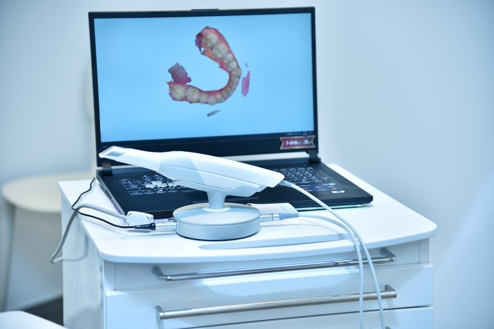 Dental intraoral 3d scanner and laptop on table in dentist office
