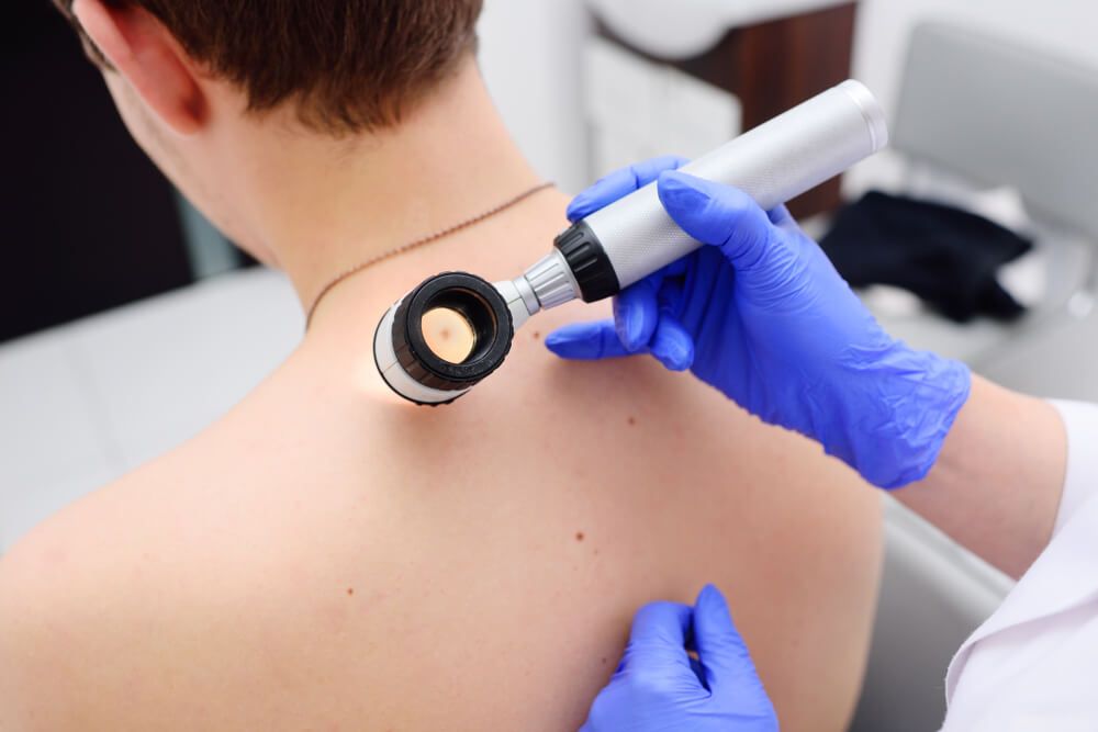 doctor examines birthmarks of the patient with a dermatoscope