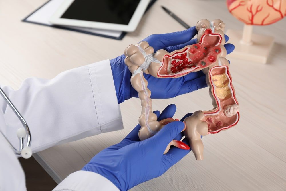 Gastroenterologist with human colon model at table