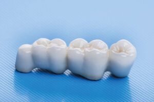 ceramic crowns