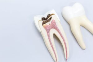 Tooth model for classroom education