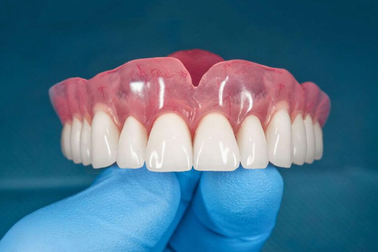 Full removable denture of the upper jaw in the hand of a dentist