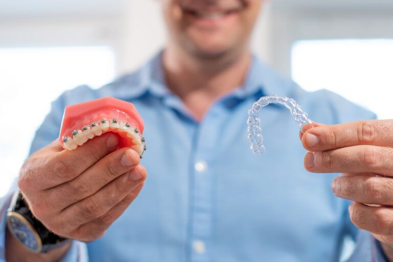 Orthodontist doctor holding aligners and braces