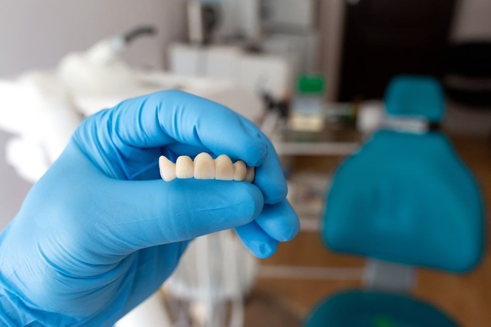 The dentist holds non-removable dental prosthesis in his hand