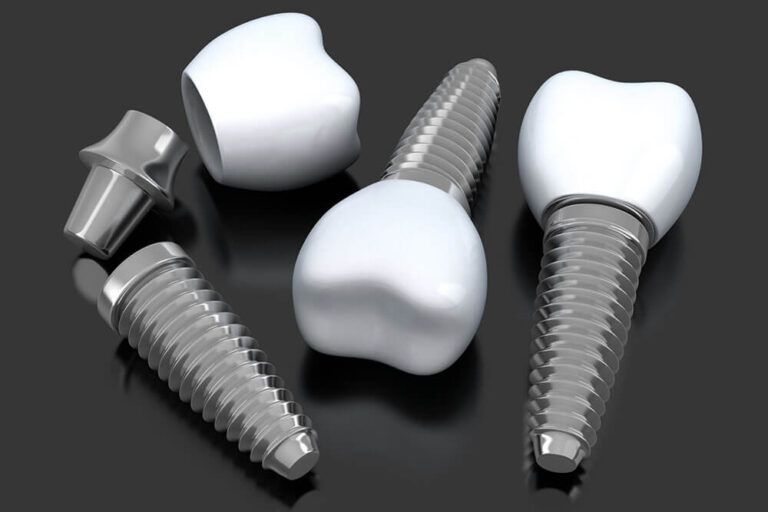 Dental implants 3D image