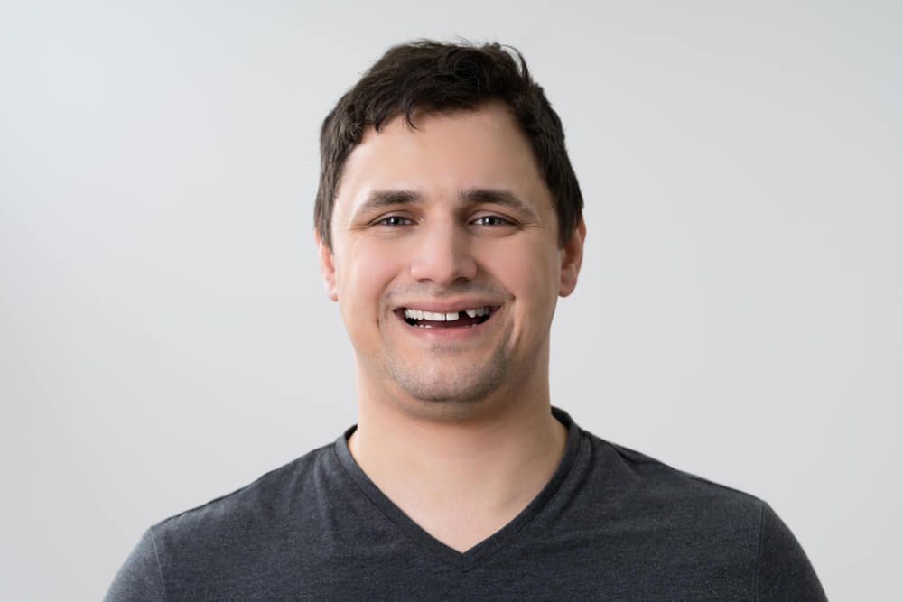 Portrait Of Young Man With Missing Tooth