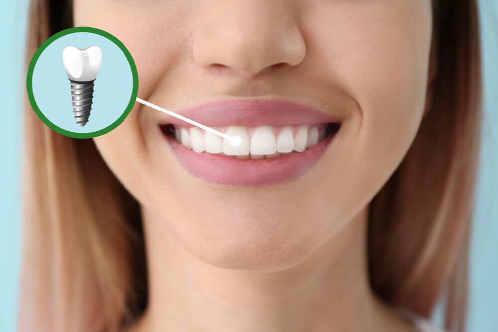 Young woman with implanted teeth, closeup