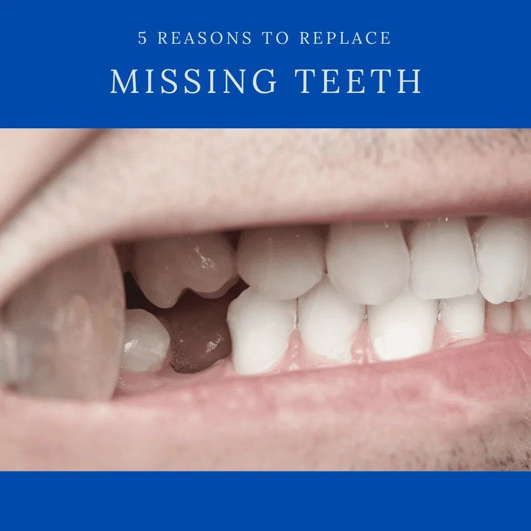 5 Reasons to Replace Missing Teeth | Chicago Dental Implants