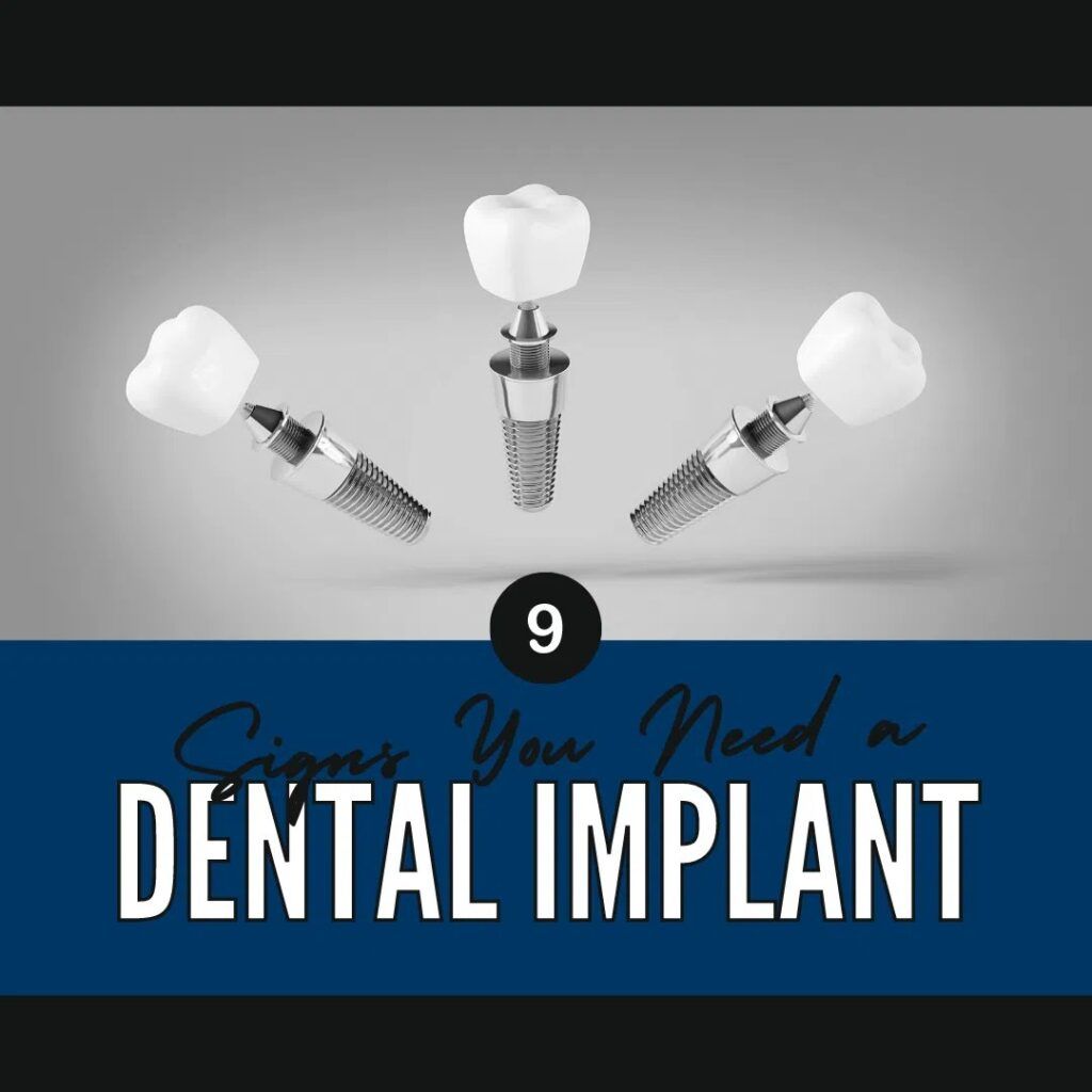 Dental Implants 3D images