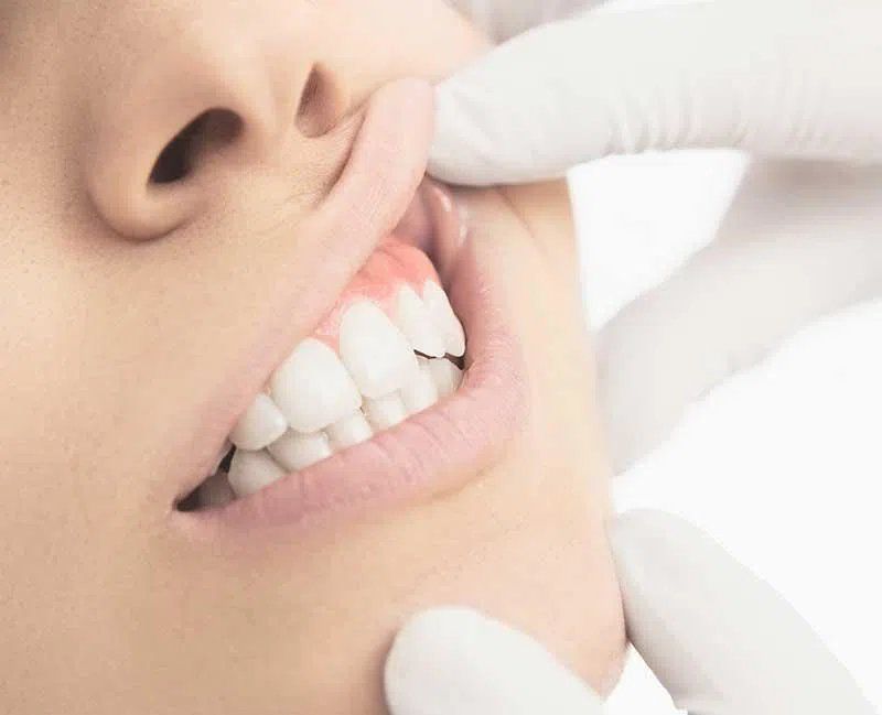Woman at dentist getting dental treatment