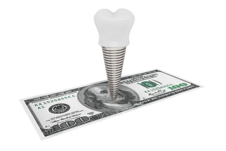 ooth Implant With Money