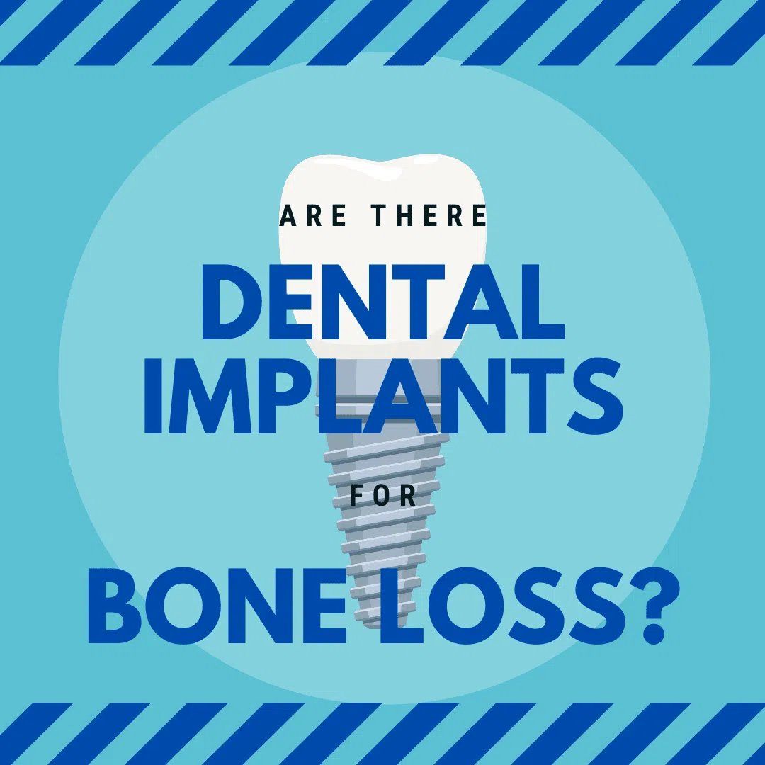 Dental Implant 2d image