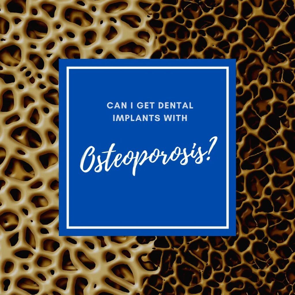 Dental Implants with Osteoporosis