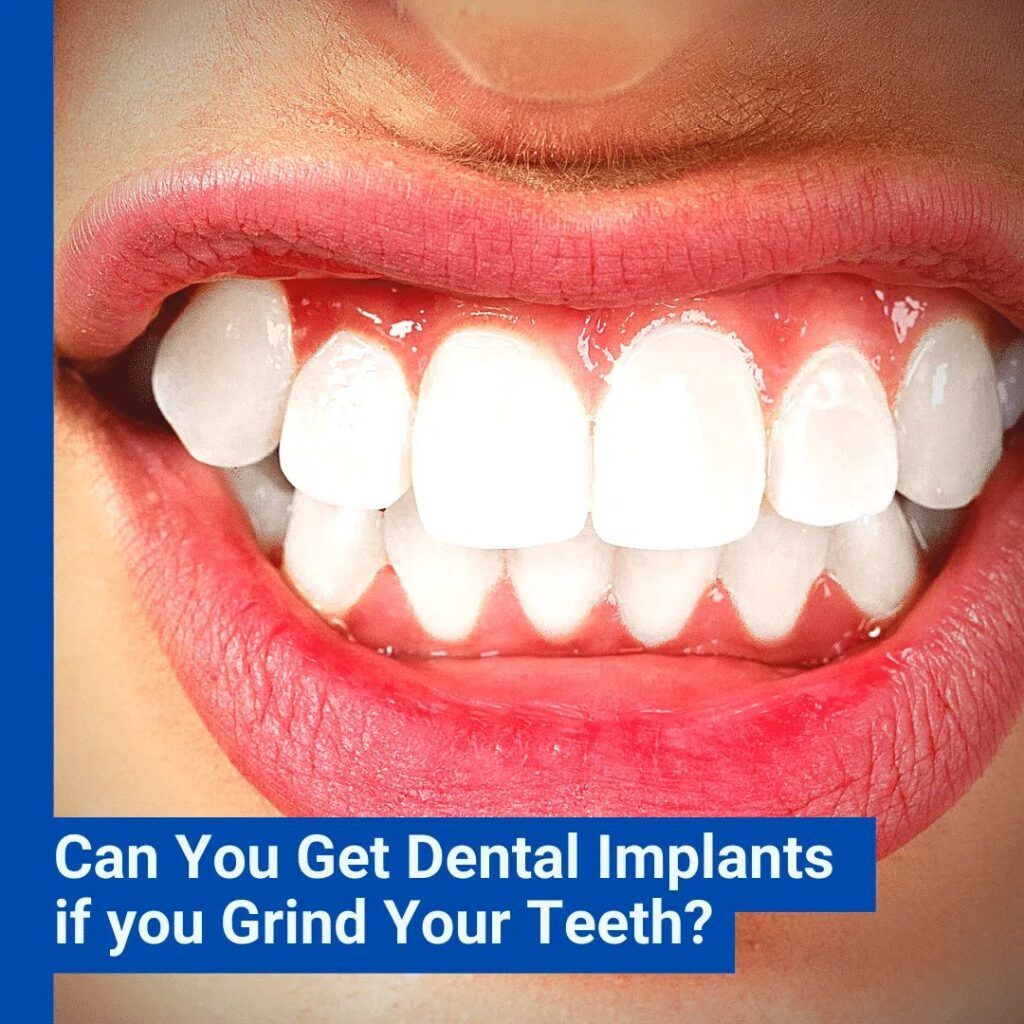 Patient with Dental Implants
