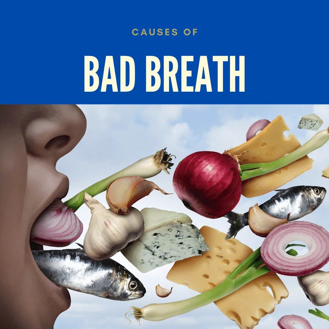 Causes of Bad Breath