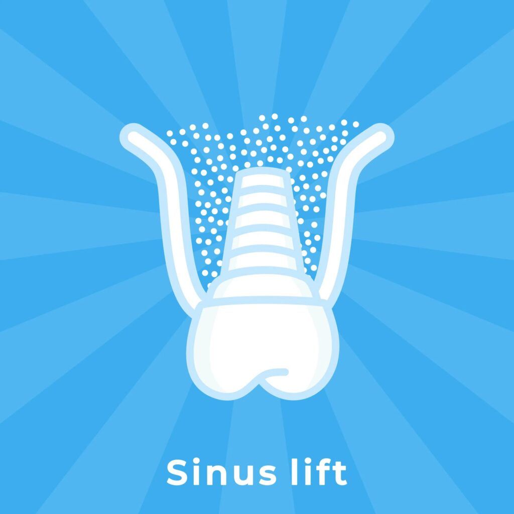 Sinus Lift Tooth Flat Line Art Drawing