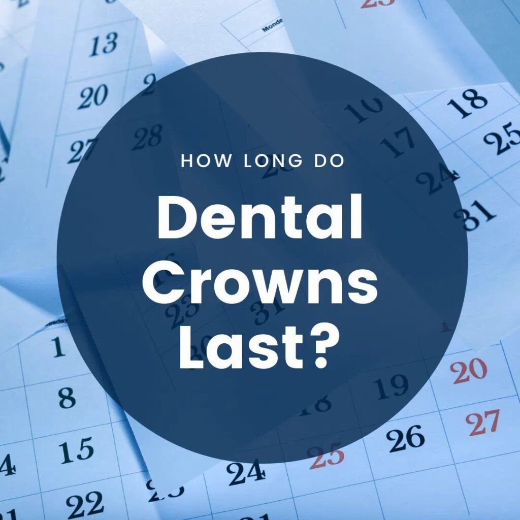 How Long Do Dental Crowns Last