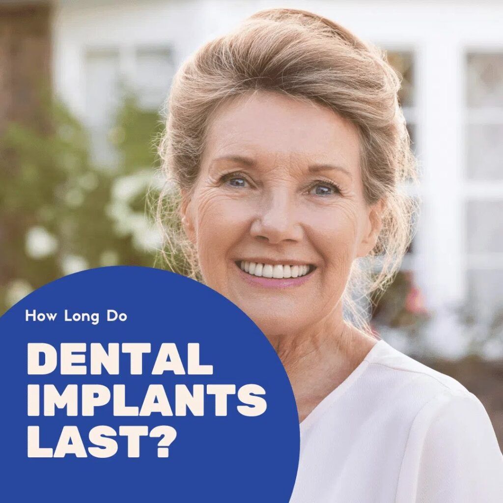 Aged woman smiling with Dental Implants