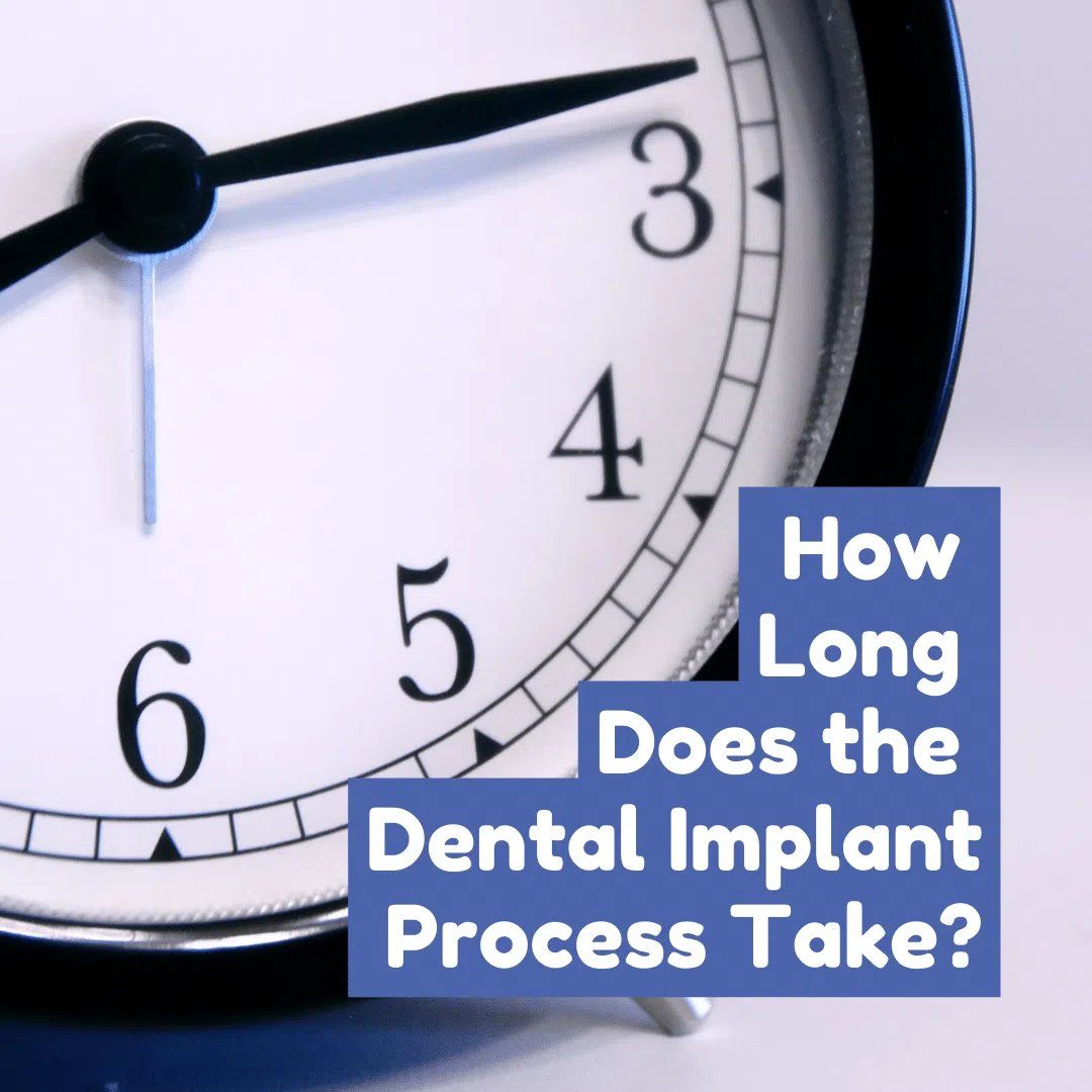 How Long Does the Dental Implant Process Take