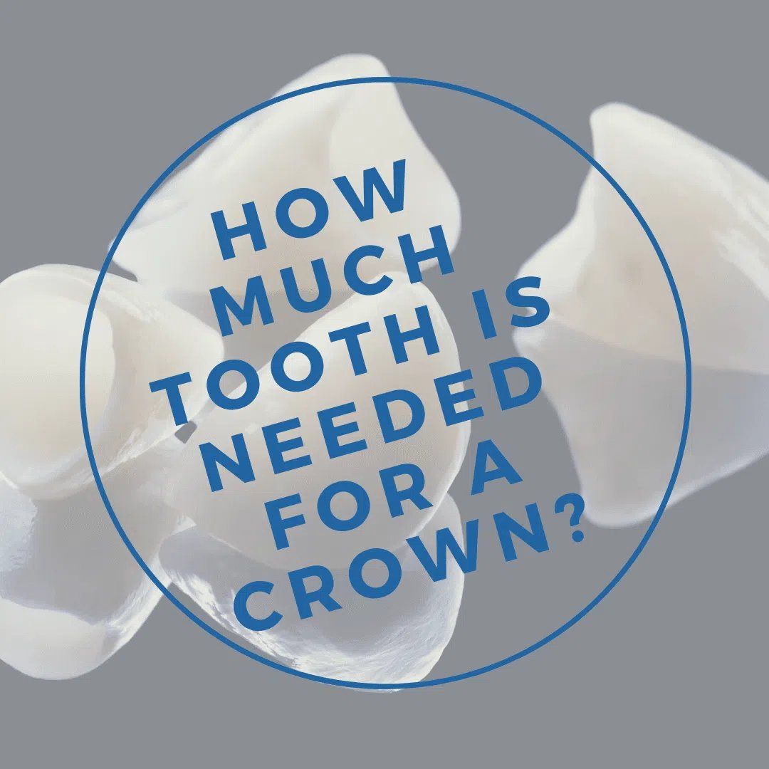 How Much Tooth is Needed for a Crown? Chicago Dental Implants