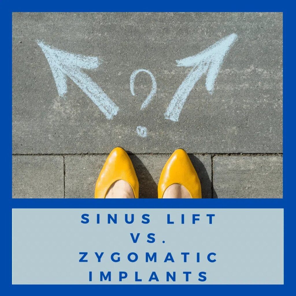 Sinus Lift vs. Zygomatic Implants