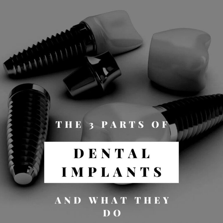 Dental Implants 3D image