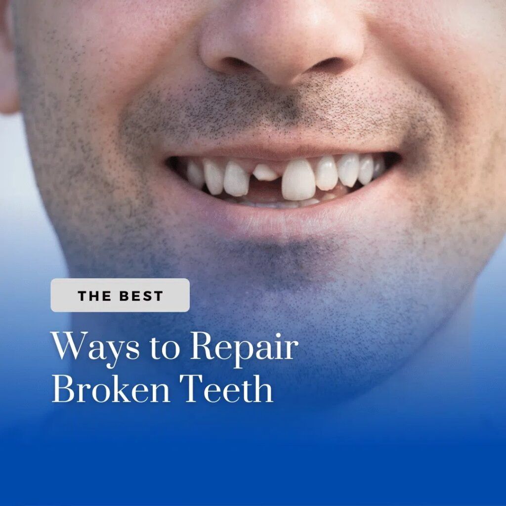 Man with broken tooth