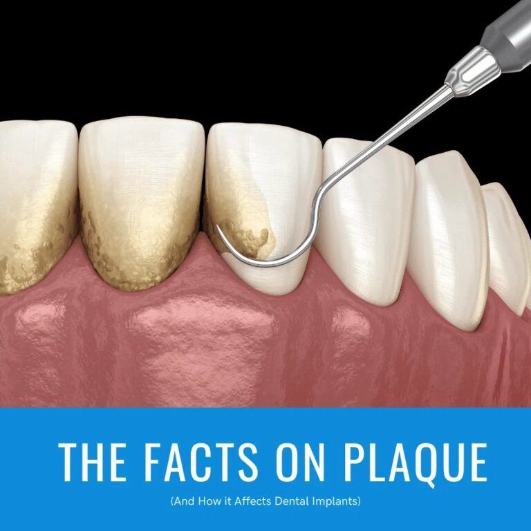 3d image of teeth cleaning