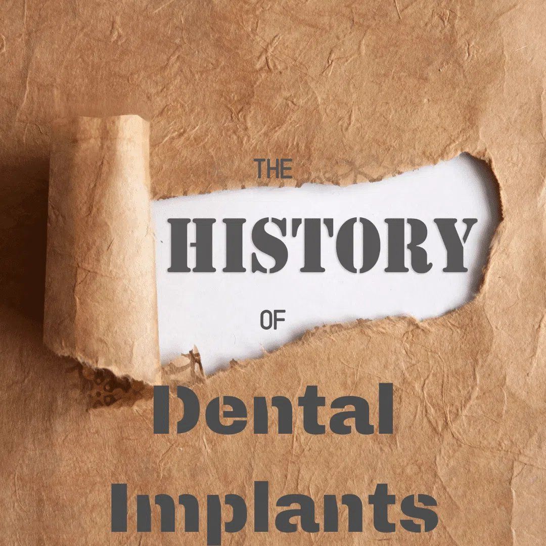 History of Dental Implants