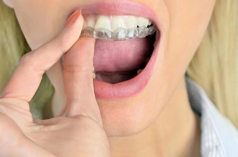Woman using Invisalign