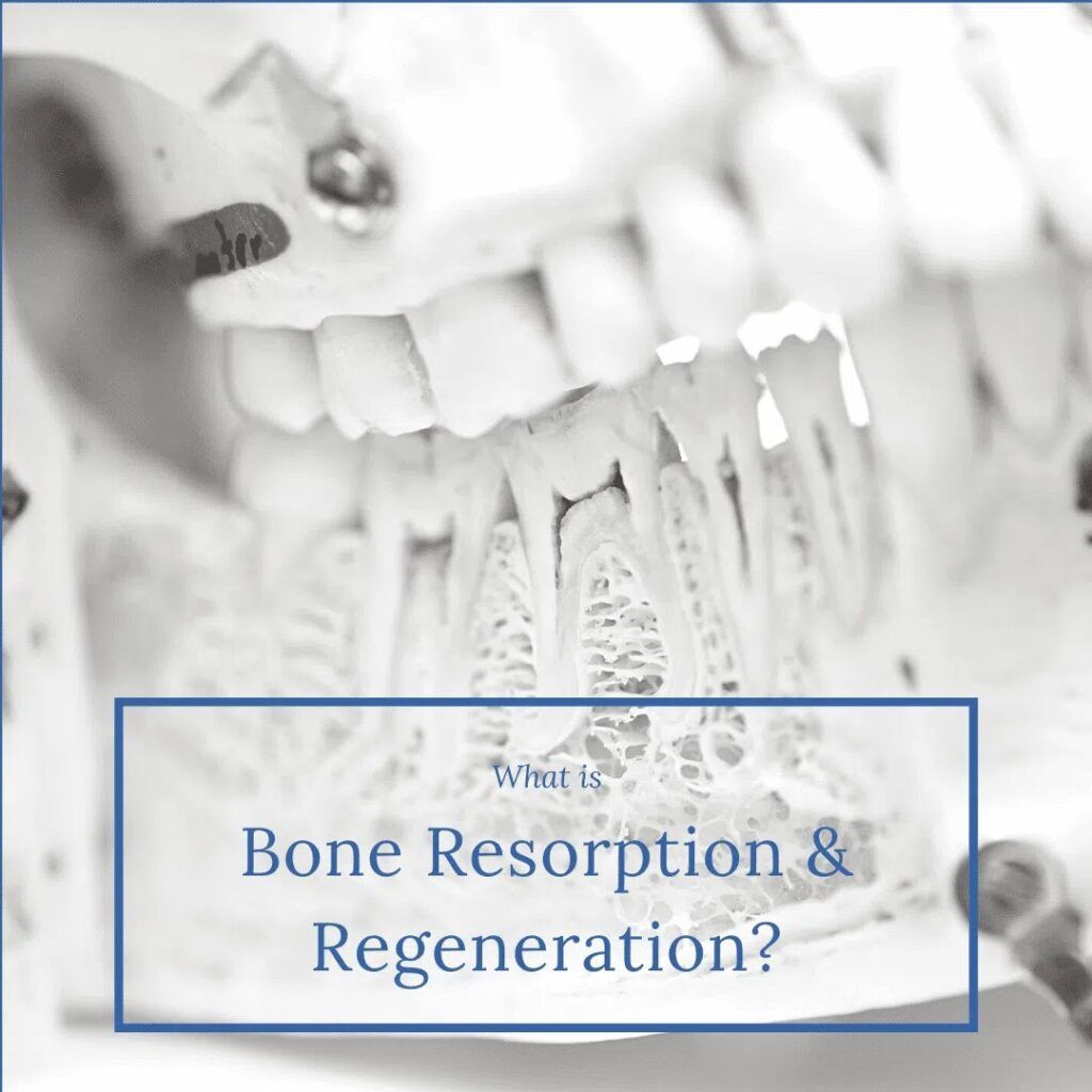 What is Bone Resorption & Regeneration? Chicago Dental Implants