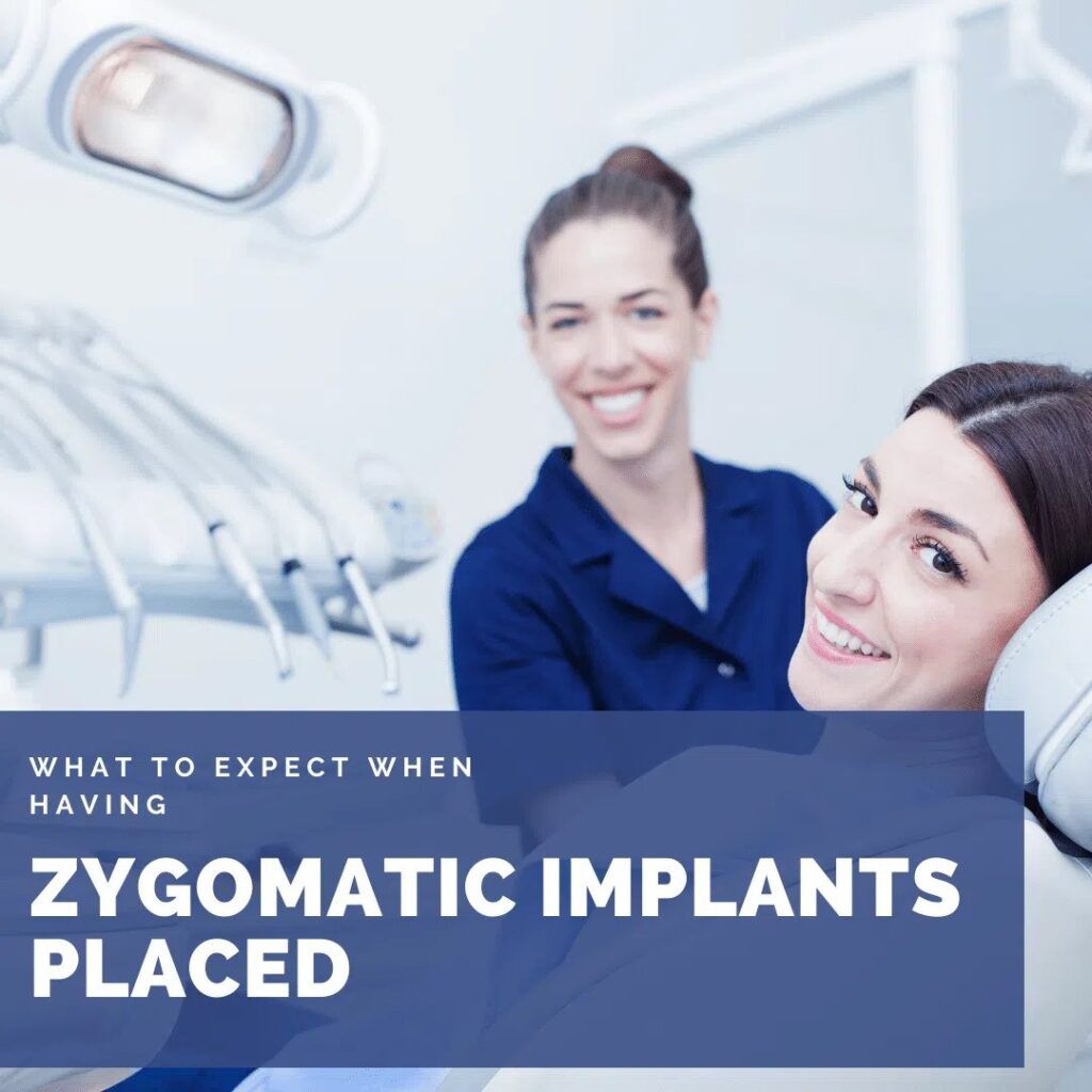Woman ready for Zygomatic Implants treatment