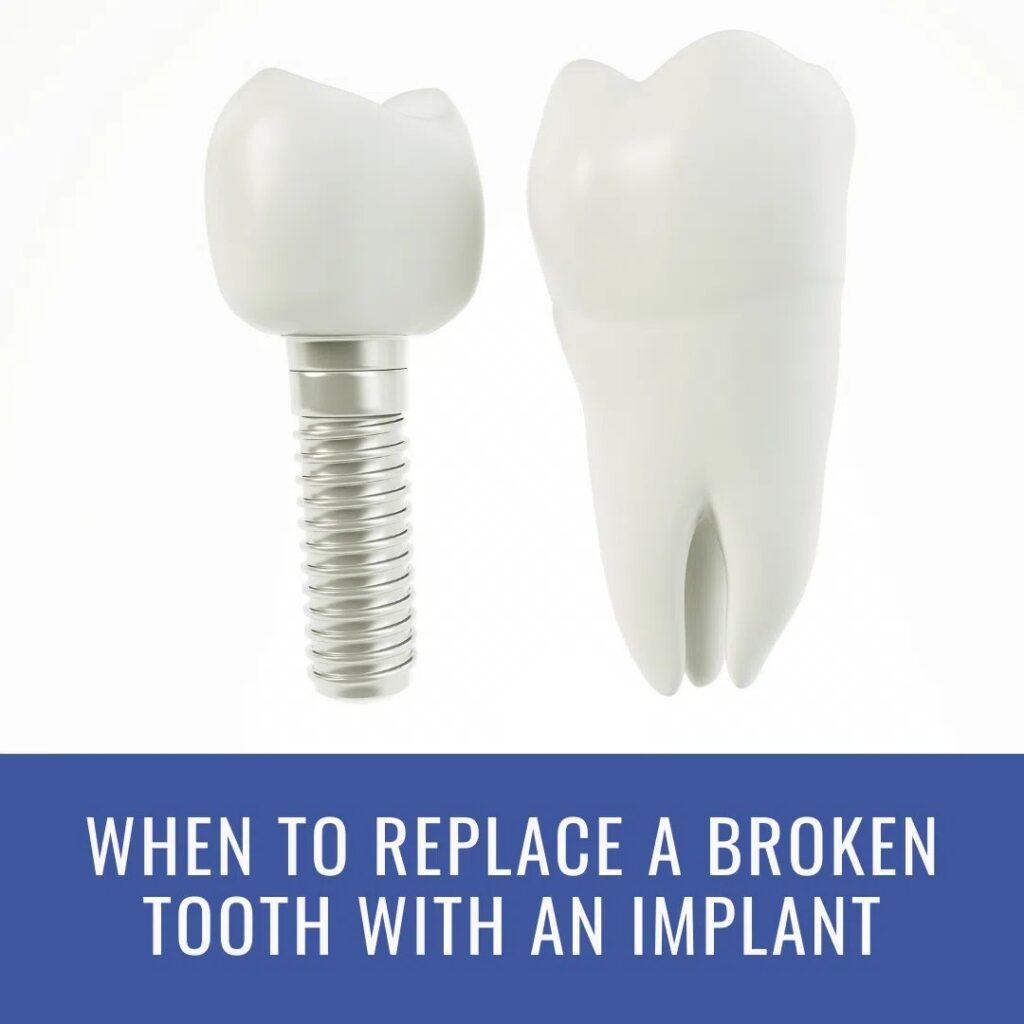 Dental Implants 3D image