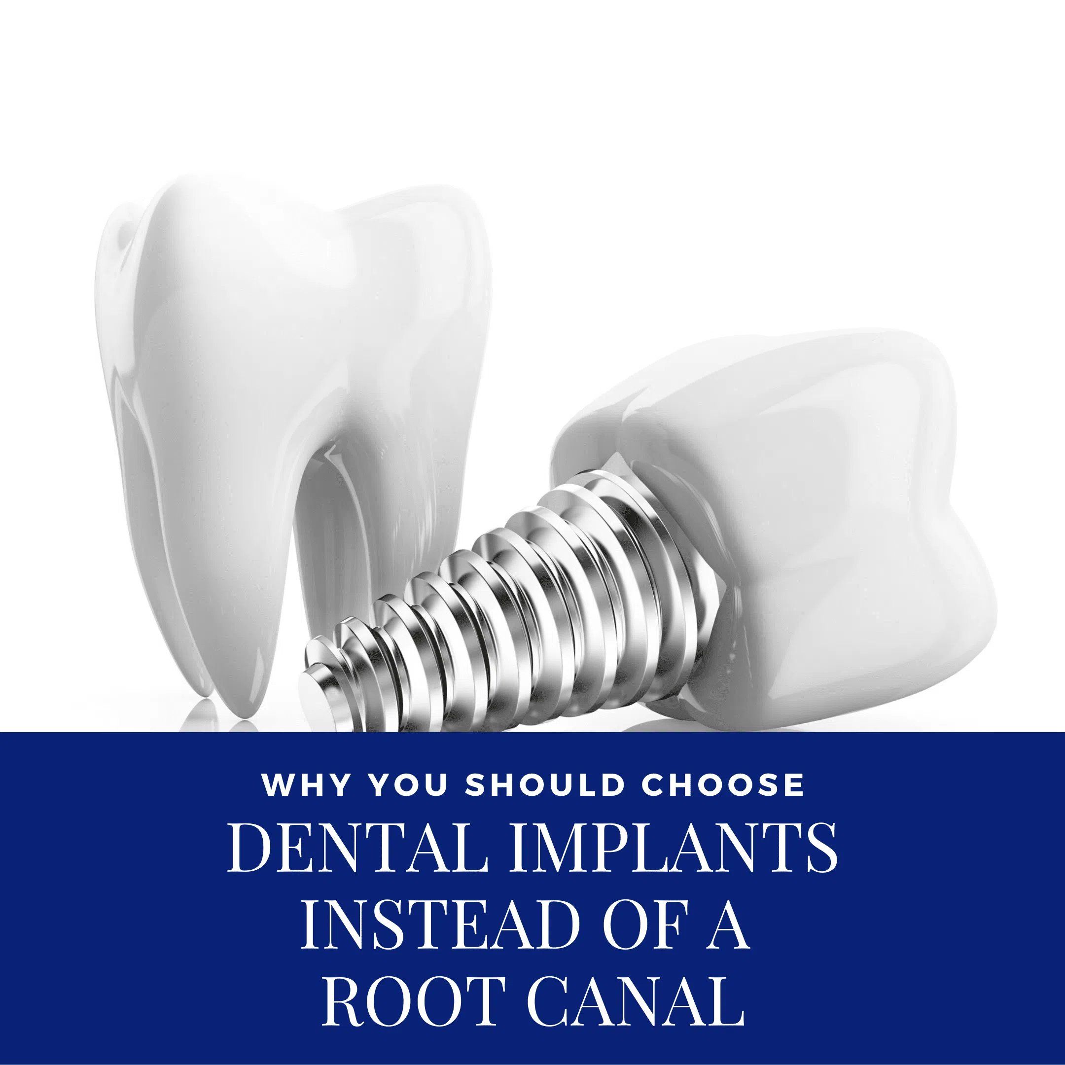 Dental Implants 3D image